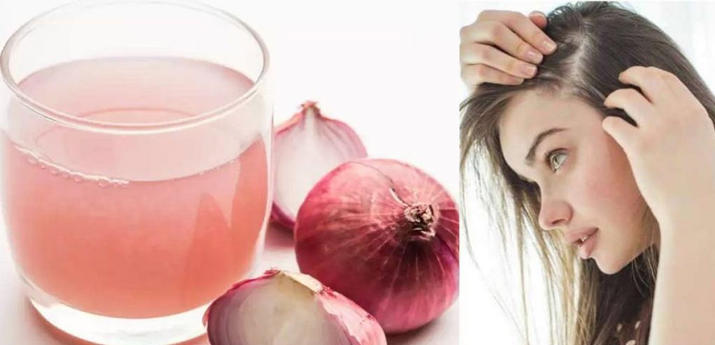 बालों में प्याज का रस