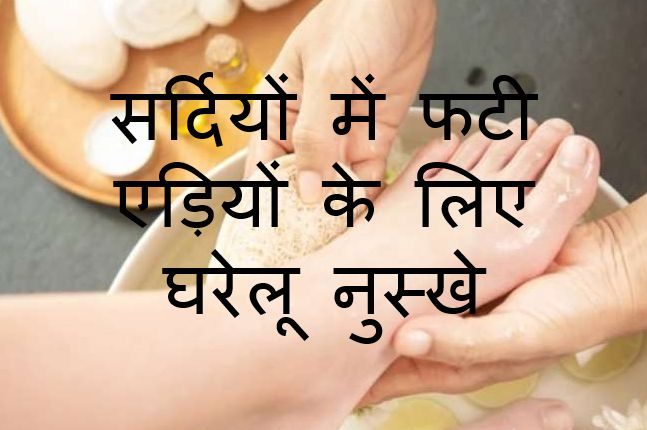 सर्दियों में फटी एड़ियों के लिए अपनाएं घरेलू नुस्खे
