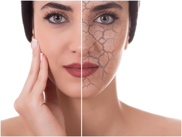 स्किन होने लगती है ड्राई