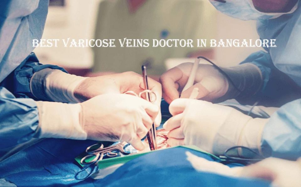 Best Varicose Veins Doctor In Bangalore