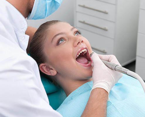 Root Canal and Fillings