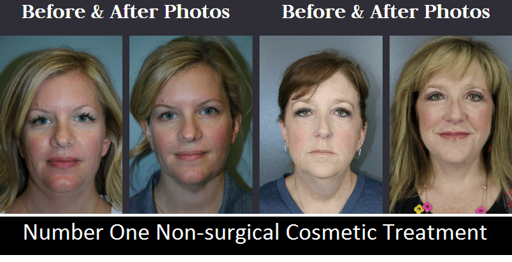 number one non-surgical cosmetic treatment - Botox injections