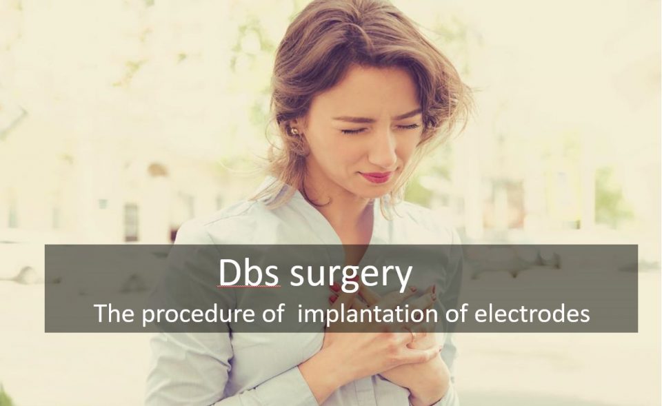 Dbs surgery