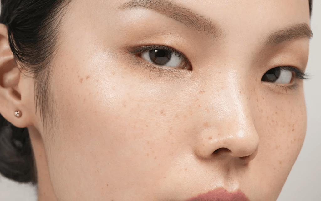 Hyperpigmentation-can-be-caused-by-a-variety-of-factors-including-the-following-1