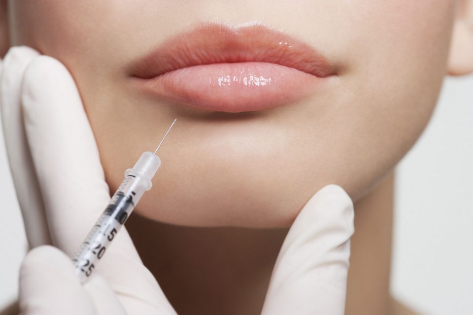Things we need to know about Lip Injections