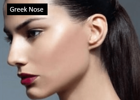 Greek Nose