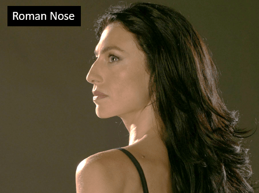 Roman Nose