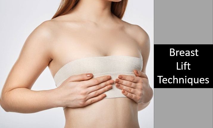 Types of Breast Lift Techniques