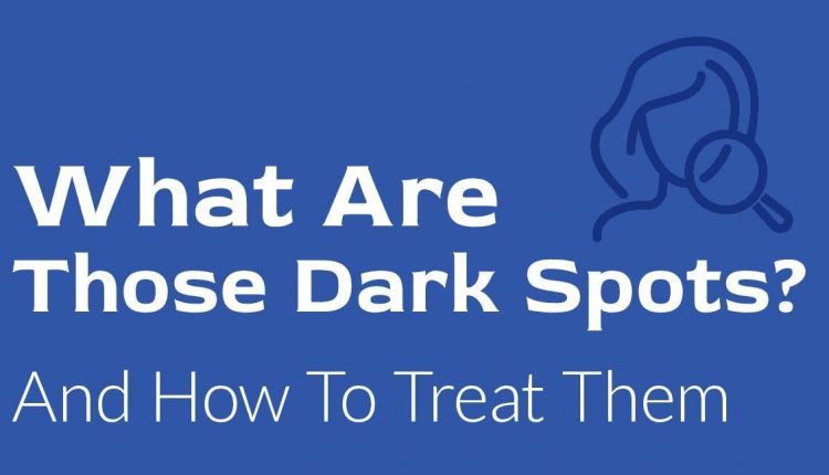 Dark Spots - Is It a Cosmetic Problem or Is It More Serious