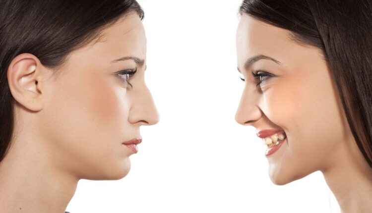 Tips to Determine if You are a Good Candidate for A Nose Job