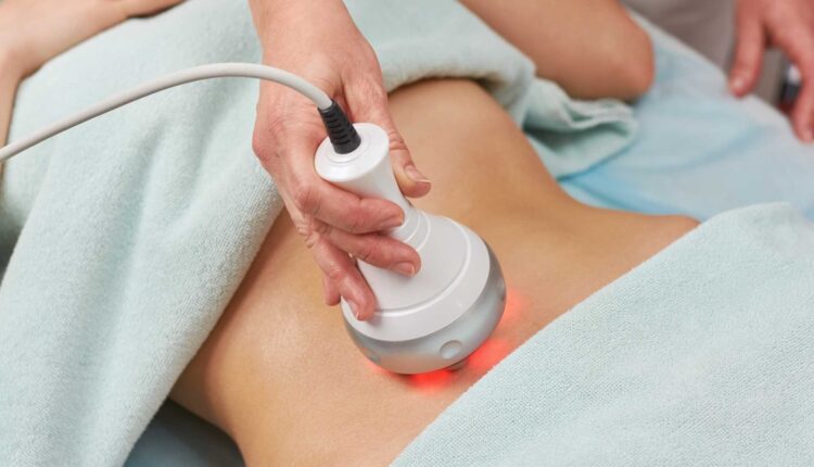 Right Contouring Method