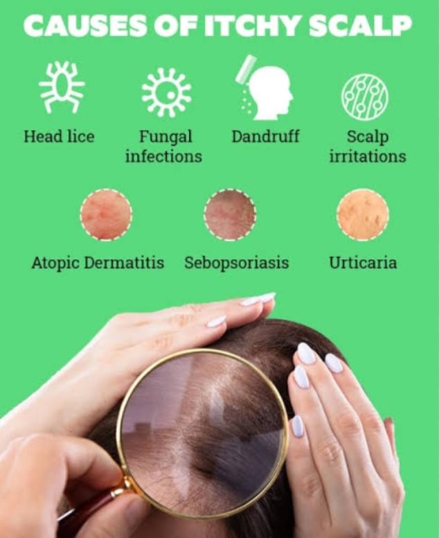 9 Best Home Remedies And Treatments For Itchy Scalp