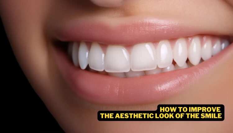 How To Improve The Aesthetic Look Of The Smile