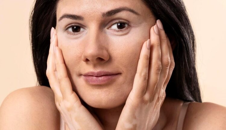 The Secrets to Flawless Skin Free from White Spots