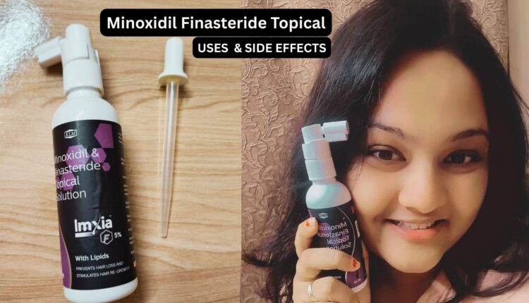 Minoxidil Finasteride Topical Review - Uses & Side Effects