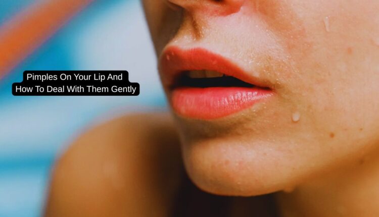 Why You Get Pimples On Your Lip And How To Deal With Them Gently